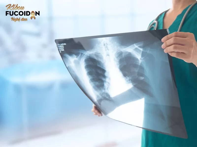 Ung thư là bệnh gì? Nguyên nhân nào dẫn đến bệnh ung thư Chụp X quang chẩn đoán ung thư