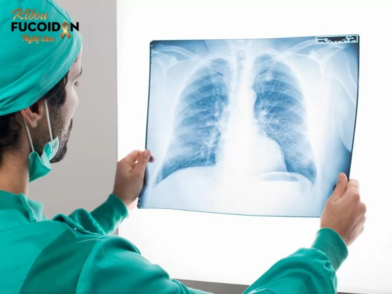 Ung thư là bệnh gì? Nguyên nhân nào dẫn đến bệnh ung thư Ung thư phổi hiện đứng đầu danh sách các bệnh ung thư