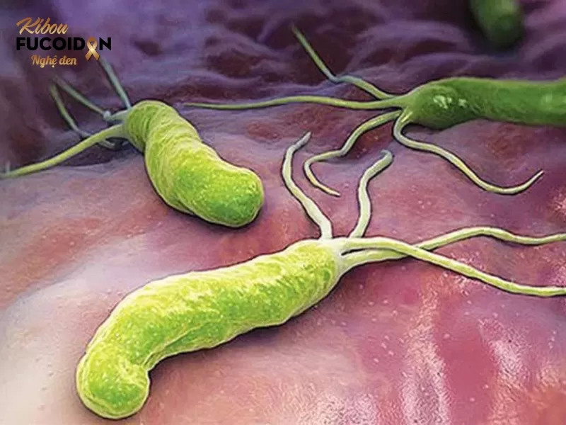 Chuyên gia giải đáp: Ung thư có lây không? Nhiễm virus HP làm tăng nguy cơ ung thư dạ dày