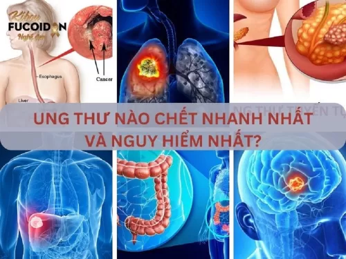 Ung thư nào chết nhanh nhất và nguy hiểm nhất?