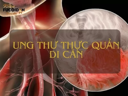 Những điều cần biết về ung thư thực quản di căn