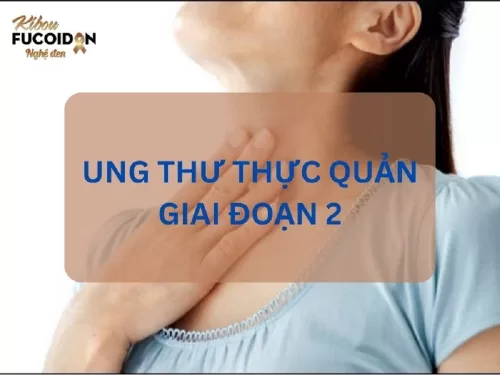 Từ A - Z về Ung thư thực quản giai đoạn 2