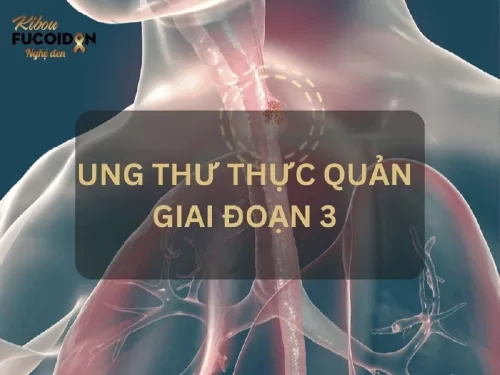 Triệu chứng và cách điều trị Ung thư thực quản giai đoạn 3