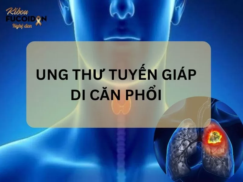 Triệu chứng, cách điều trị và tiên lượng Ung thư tuyến giáp di căn phổi Ung thư tuyến giáp di căn phổi là gì?