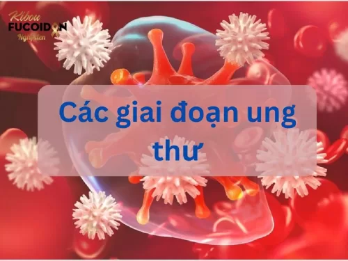 Những điều cần biết về các giai đoạn ung thư