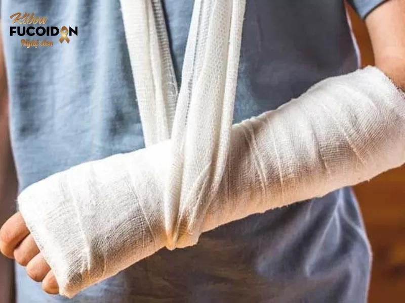 Tất tần tật về Ung thư di căn xương Ở những bệnh nhân di căn xương, xương có thể dễ bị gãy mà không cần dùng quá nhiều lực