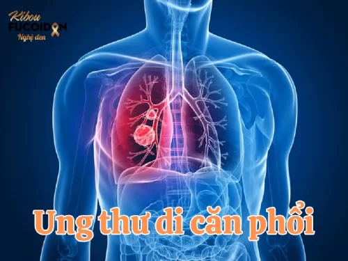 Những điều cần biết về ung thư di căn phổi