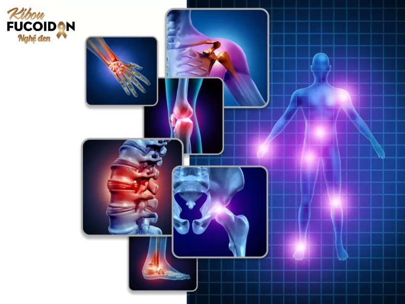 Tất tần tật về Ung thư di căn xương Ung thư có khả năng xâm lấn bất kỳ xương nào