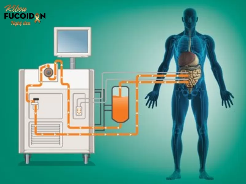 Ung thư di căn phúc mạc và những điều cần biết Hoá trị trong phúc mạc