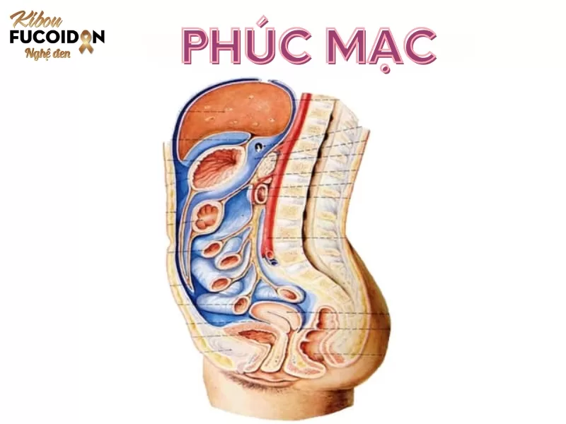 Ung thư di căn phúc mạc và những điều cần biết Phúc mạc là màng mỏng bảo vệ và che phủ các cơ quan nội tạng trong khoang bụng và hố chậu