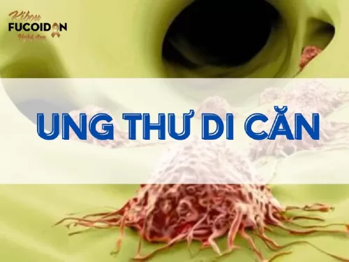 Ung thư di căn sống được bao lâu? Triệu chứng và cách điều trị