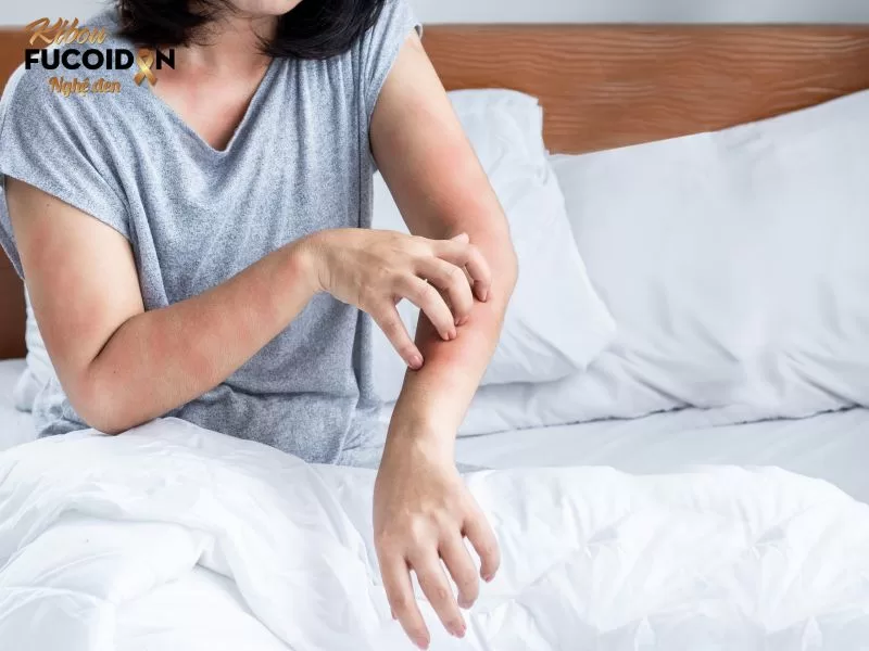 Người bị dị ứng với đậu phộng hoặc đậu nành cũng cần thận trọng khi sử dụng đậu xanh