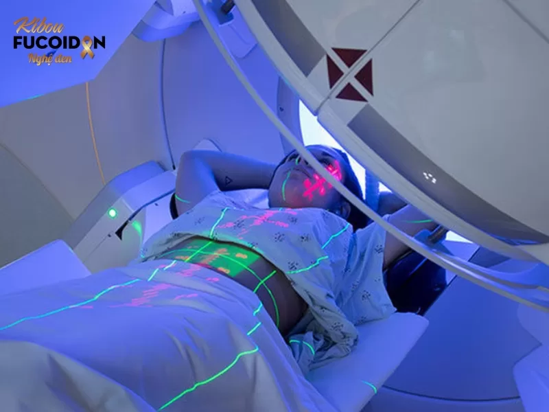 Triệu chứng, cách chẩn đoán và điều trị Ung thư di căn hạch Xạ trị là phương pháp điều trị chính hoặc bổ trợ cho phẫu thuật trong điều trị di căn hạch