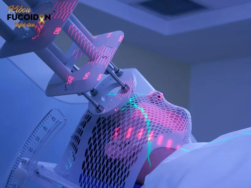 Xạ trị sử dụng tia X năng lượng cao để tiêu diệt tế bào ung thư