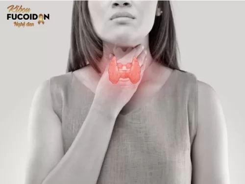 Vôi hóa tuyến giáp là hiện tượng lắng đọng muối canxi trong các mô của tuyến giáp