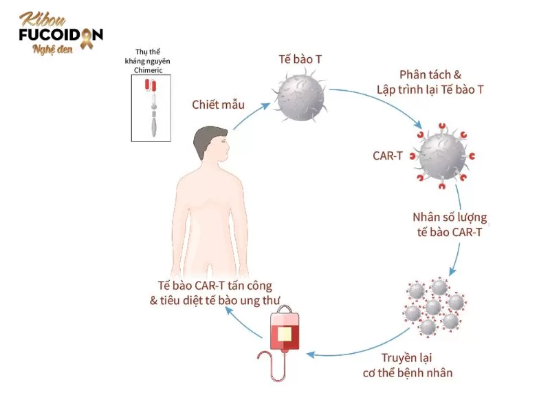 Liệu pháp miễn dịch trong điều trị ung thư có thật sự hiệu quả? Liệu pháp miễn dịch CAR-T.