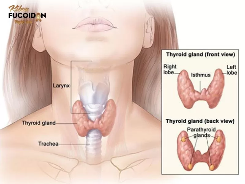 Phình giáp là bệnh gì? Phình giáp có nguy hiểm không? Phình giáp đa nhân 2 thùy