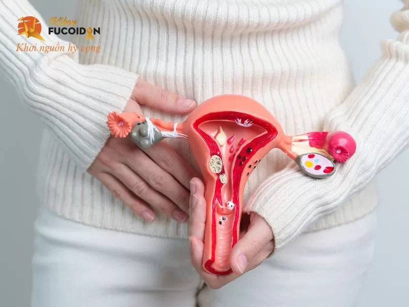 U xơ tử cung là khối u lành tính phát triển từ cơ trơn của tử cung U xơ tử cung là khối u lành tính phát triển từ cơ trơn của tử cung