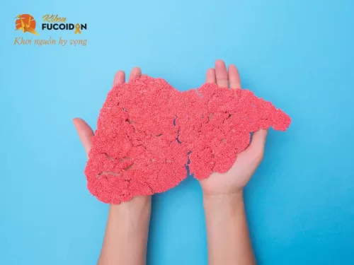 Chi phí 1 ca ghép gan? Điều kiện ghép gan, hiến gan