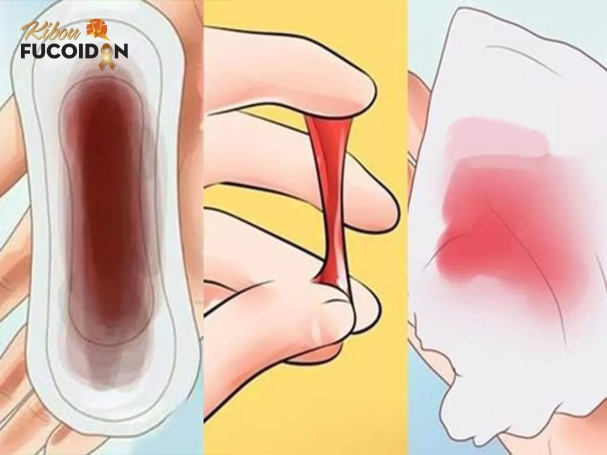 Ung Thư Cổ Tử Cung: Nguyên Nhân, Dấu hiệu Và Cách Phòng Ngừa Một số dấu hiệu mắc ung thư cổ tử cung