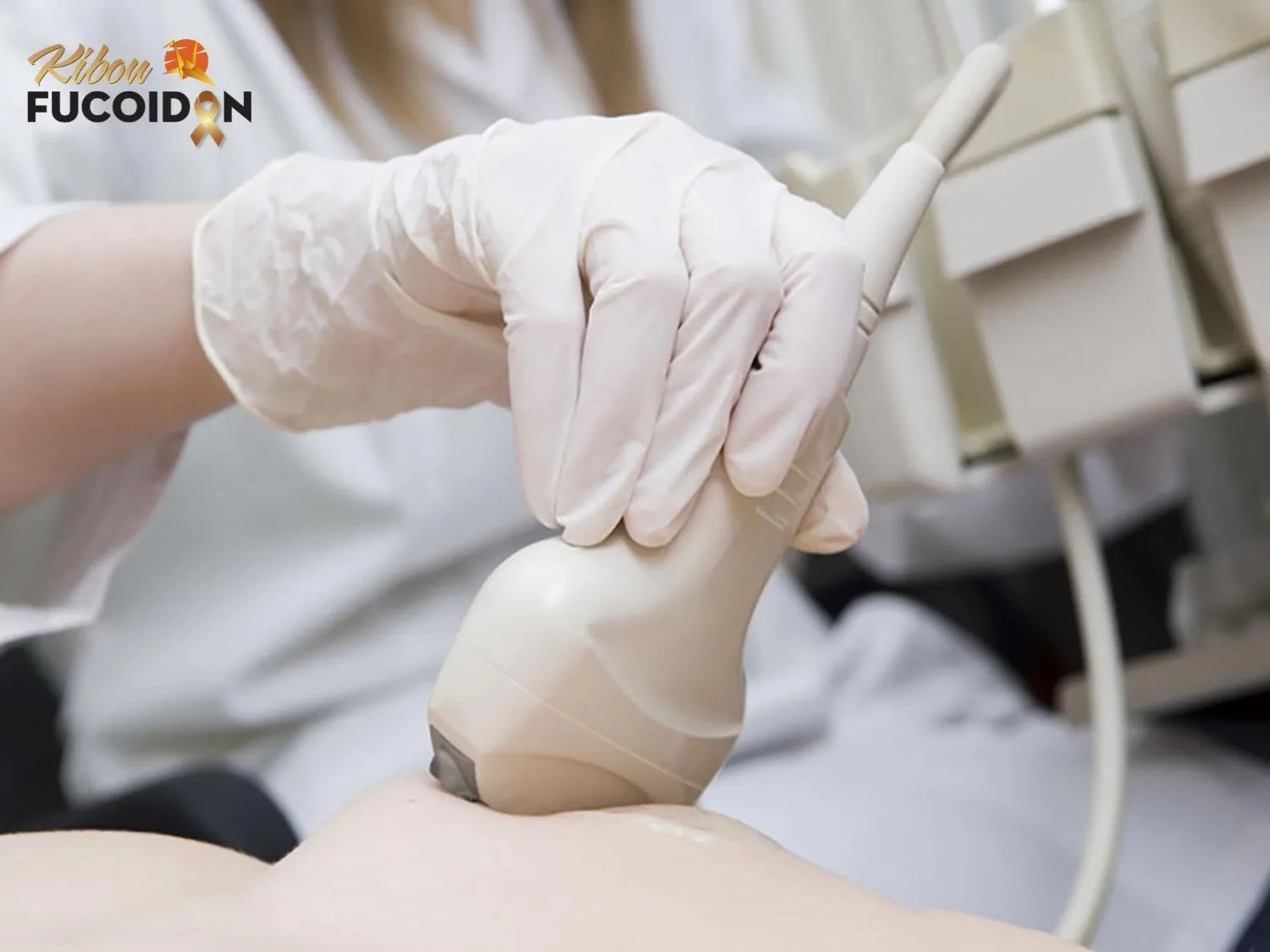 Phát hiện ở giai đoạn đầu tăng tỷ lệ chữa khỏi thành công 