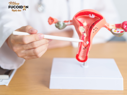 4 Giai Đoạn Ung Thư Cổ Tử Cung – Hiểu Rõ Để Phát Hiện Sớm & Hồi Phục Toàn Diện Ung thư cổ tử cung