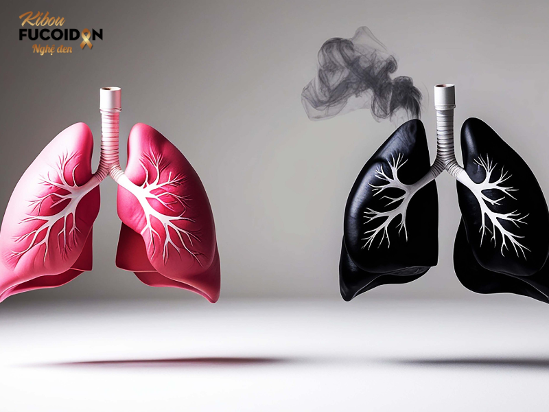 Ở giai đoạn sớm, khối u phổi thường chưa gây chèn ép lên dây thần kinh