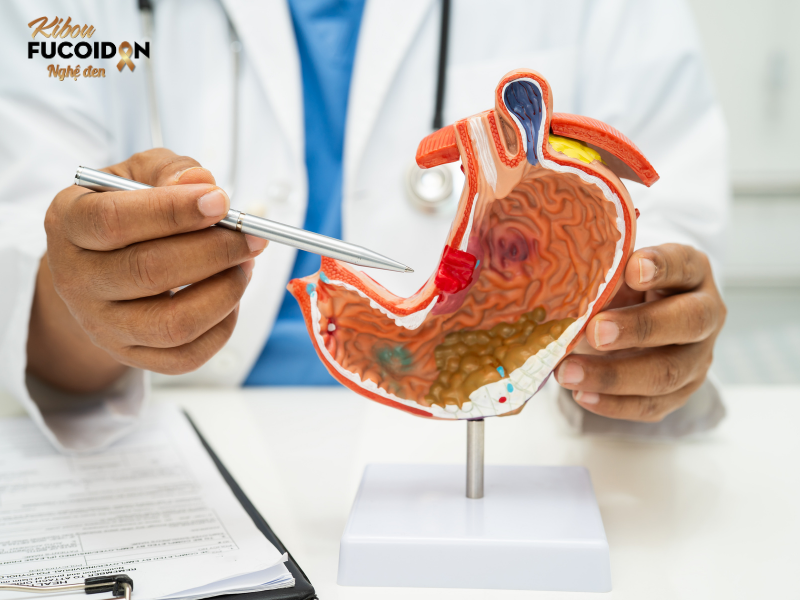 UNG THƯ DẠ DÀY NÊN ĂN GÌ? LỜI GIẢI CHO NỖI LO "MÙA TIỆC TÙNG" Hình ảnh ung thư dạ dày