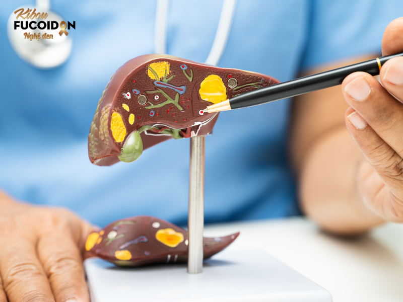 UNG THƯ GAN CÓ CHỮA ĐƯỢC KHÔNG? CÂU HỎI LỚN MÙA TIỆC TÙNG Hình ảnh minh họa ung thư gan